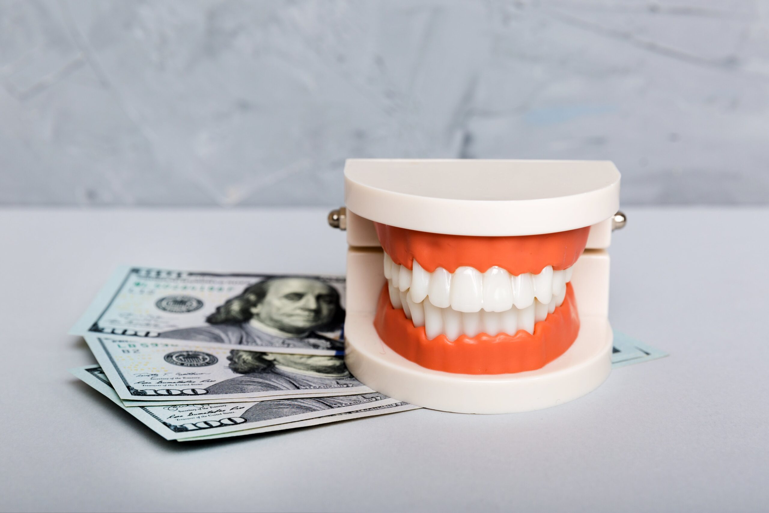 Closeup model of a human jaw with white teeth and dollar bill.