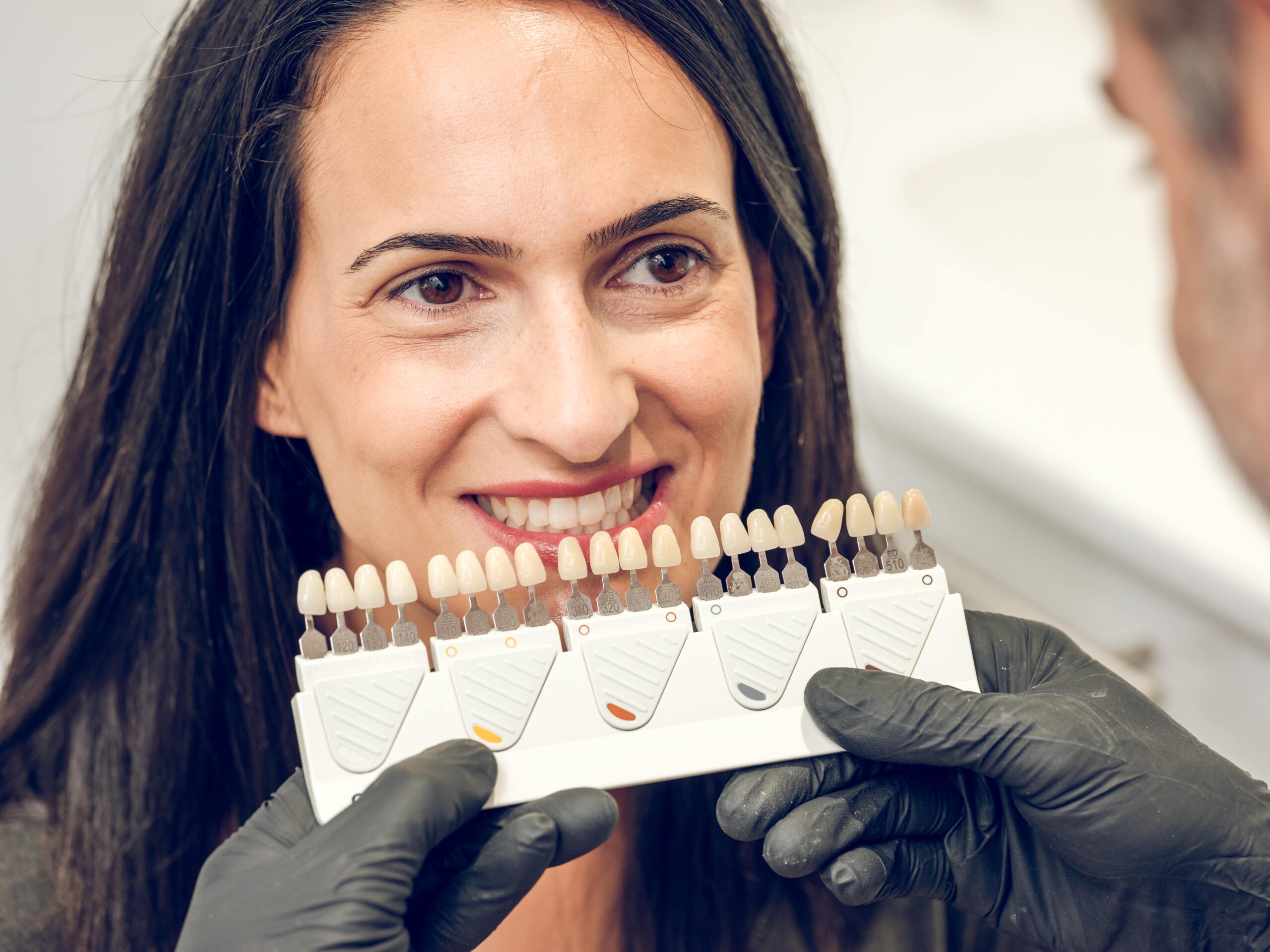 Dentist man matching shades of implants for denture for woman