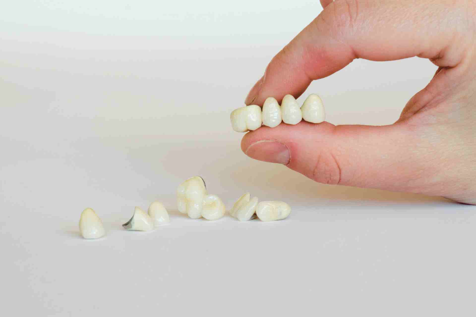 Dental professional holding a dental bridge.