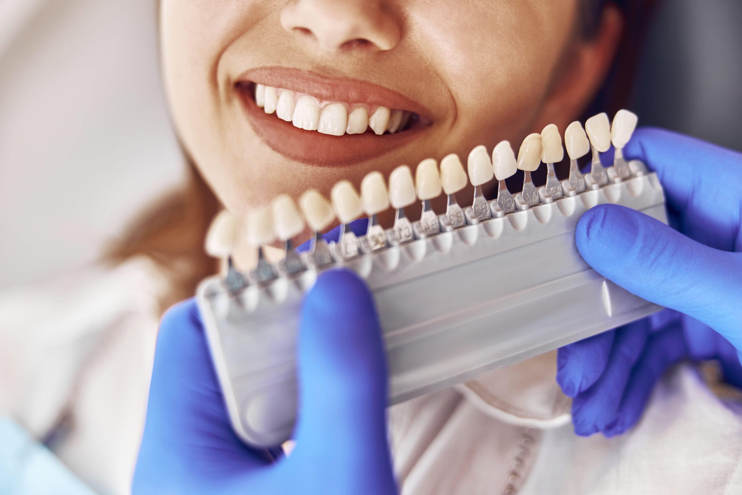 Female patient is choosing a color of teeth in modern dental clinic.