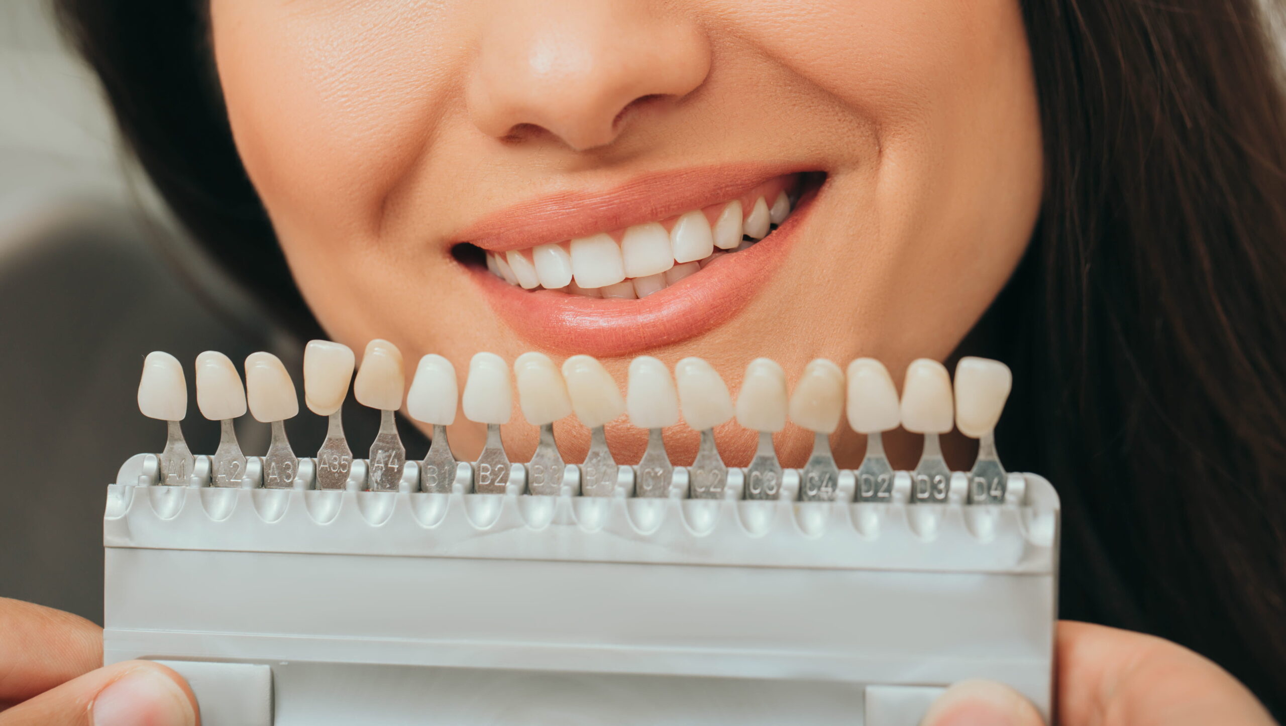 Teeth palette with different shades of teeth near female smiling.